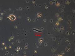 Protozoa