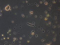 Protozoa