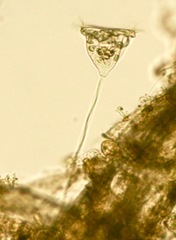 Vorticella