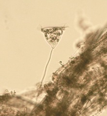 Vorticella