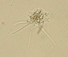 Mayorellidae
