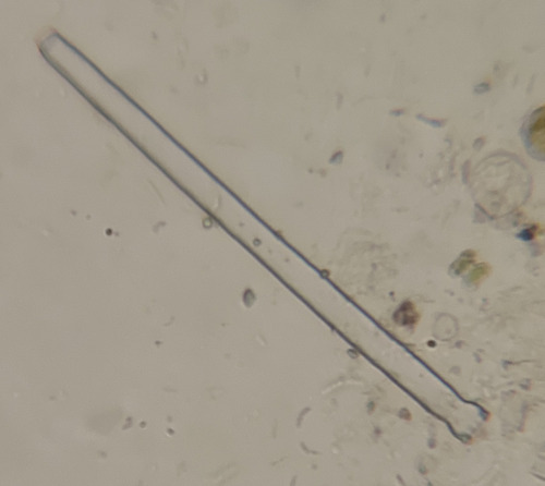 Docidium baculum