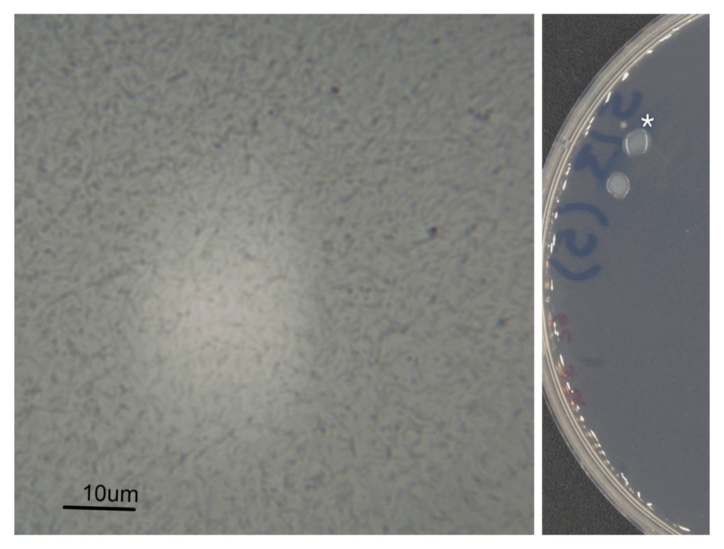 Medio R2a Bacteria from Distrito Federal, MX on September 1, 2025 by Luis Gerardo ...