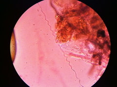 Steccherinaceae