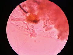 Steccherinaceae