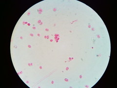 Steccherinaceae