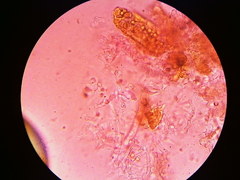 Steccherinaceae