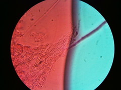 Steccherinaceae