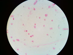 Steccherinaceae