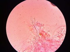 Steccherinaceae