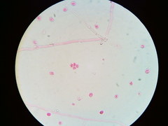 Steccherinaceae