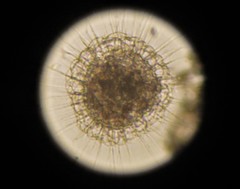Actinosphaerium