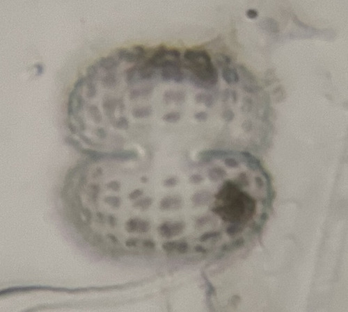 Cosmarium orthostichum