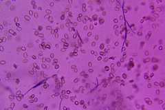 Psathyrella subhyalinispora