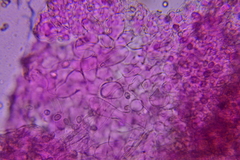 Psathyrella subhyalinispora