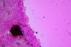 Psathyrella subhyalinispora