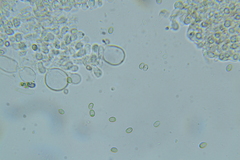 Psathyrella subhyalinispora