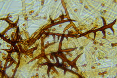 Inonotus cuticularis