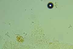 Basidiodendron deminutum