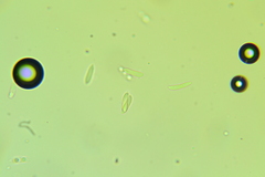 Ascocoryne albida