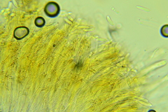 Ascocoryne albida