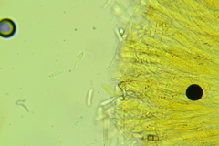 Ascocoryne albida