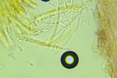 Ascocoryne albida