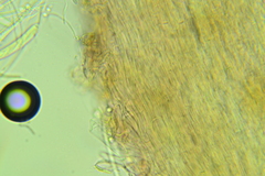 Ascocoryne albida