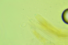 Ascocoryne albida