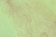 Ascocoryne albida