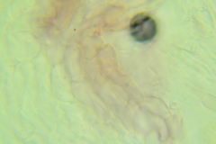 Ascocoryne albida