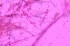 Sporophagomyces