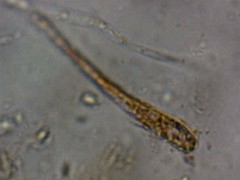 Anthracobia macrocystis