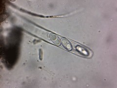 Anthracobia macrocystis