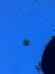 Vorticella campanula