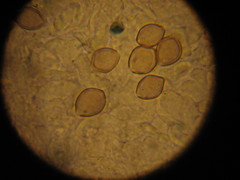 Psilocybe ovoideocystidiata