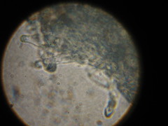 Psilocybe ovoideocystidiata