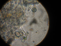 Psilocybe ovoideocystidiata