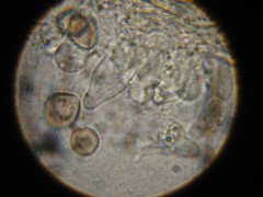 Psilocybe ovoideocystidiata