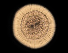 Actinosphaerium