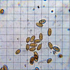 Psilocybe cyanofibrillosa