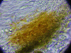 Xylographa rubescens