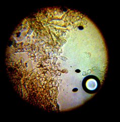 Panaeolus subbalteatus