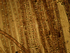 Zygogonium ericetorum