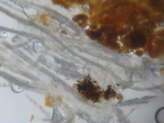 Tilachlidium brachiatum image