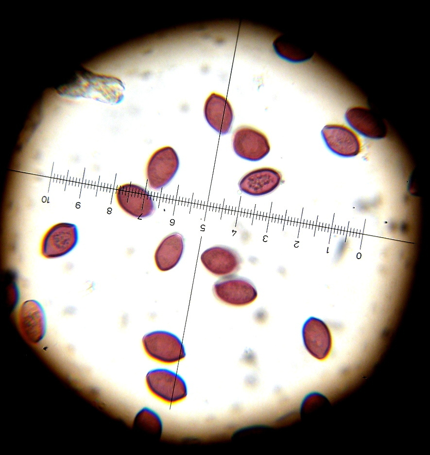 Spores microscopy