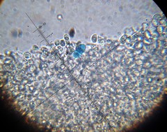 Leucoagaricus coerulescens