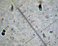 Leucoagaricus coerulescens