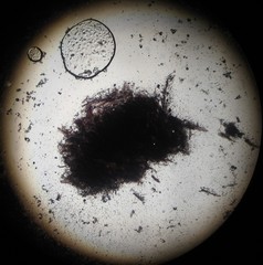 Hypochnella violacea