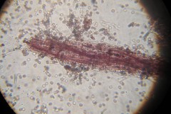 Hypochnella violacea